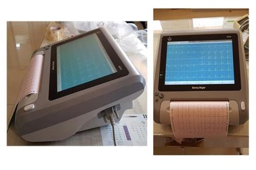 درمان یك ماهه زخم پای دیابتی بوسیله تحریك الكتریكی