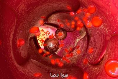 ارائه راهکاری در حوزه درمان سرطان توسط پژوهشگران کشور