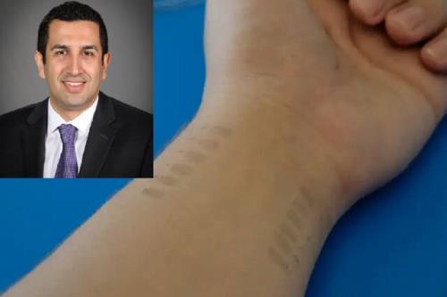 خالکوبی هایی که فشار خون را اندازه گیری می کنند!