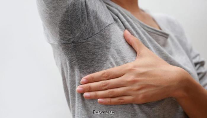 بوتاکس زیربغل و هزینه آن