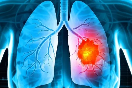 درمان تغییرات ایجادشده در میکروبیوم ریه بر اثر سیگار کشیدن