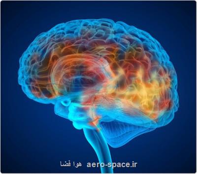 كوشش برای طراحی سیستم تحریك غیر تهاجمی مغز برای درمان میگرن و اعتیاد