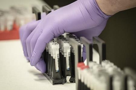 كشف آنتی بادی كه از مبتلاشدن به كووید۱۹ جلوگیری می كند