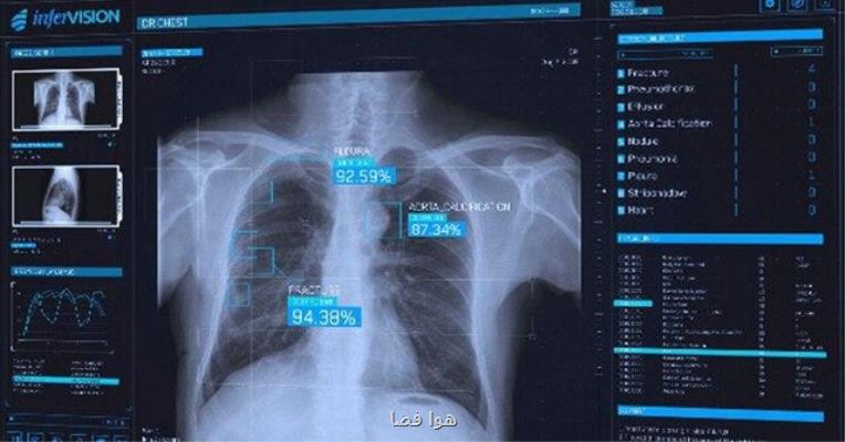 شناسایی مبتلایان به ویروس كرونا با هوش مصنوعی