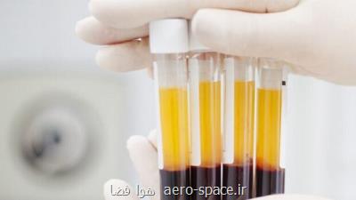 كیفیت پادتن عامل تعیین كننده مرگ یا بهبودی از كرونا